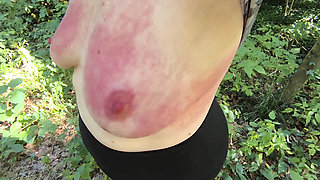 Red Breasts in the Forest