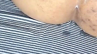 Village Girl Anal Sex - Asshole Stretched Hard