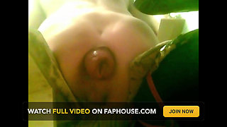 A Young Guy Is Sitting on a Chair with Anal Prolapse