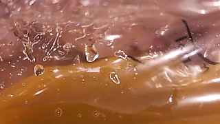 Cripple Problems 101: I Have to Drain Using a Catheter Because My Bladder Was Not Releasing