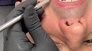 Nurse Bunny Checks Dr. Canada's Teeth Multi Angle
