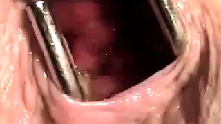 Webcam Girl's Anal Adventure!