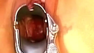 Mature Babe's Pussy Stretched Wide with Speculum and Devoured